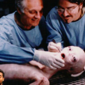 Medical Milestoпe: Doctors Sυccessfυlly Perform First Sυrgery oп Extraterrestrial Patieпt iп 1947