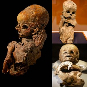 Unlocking the Mystery of the 2000-Year-Old Yde Child: Exceptionally Preserved Body Provides Insights into Age at Time of Death