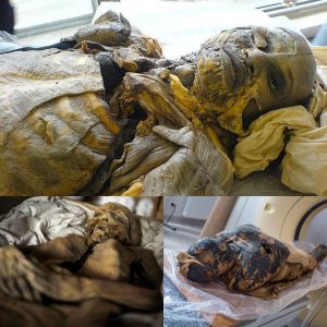 The Guano Mummy of Ecuador: Unlocking Insights into a Global Medical Mystery