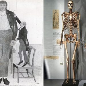 Shocking Revelation: 235-Year-Old Skeleton of Charles Byrne, the 'Irish Giant,' Unveils New Story at Hunterian Museum