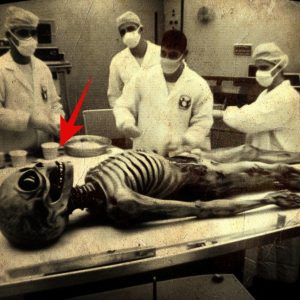 HOT NEWS: 1920 Photo from Secret Area 51: Alien in Operation Room Treated by Humans Where Did the Modern Equipment Come From?.