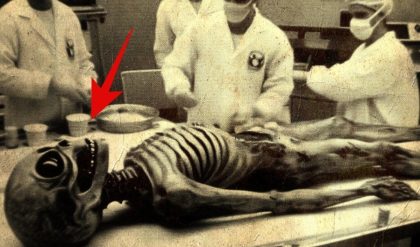 HOT NEWS: 1920 Photo from Secret Area 51: Alien in Operation Room Treated by Humans Where Did the Modern Equipment Come From?.